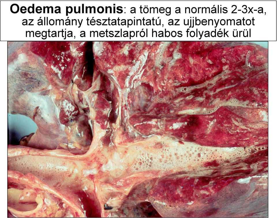 tésztatapintatú, az ujjbenyomatot
