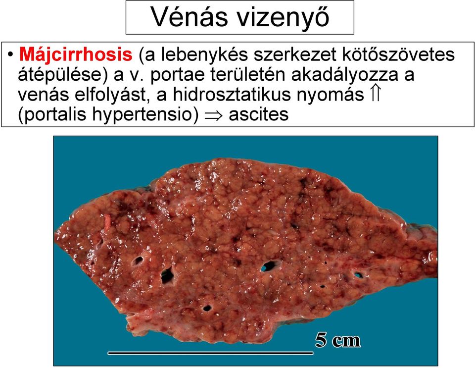 portae területén akadályozza a venás