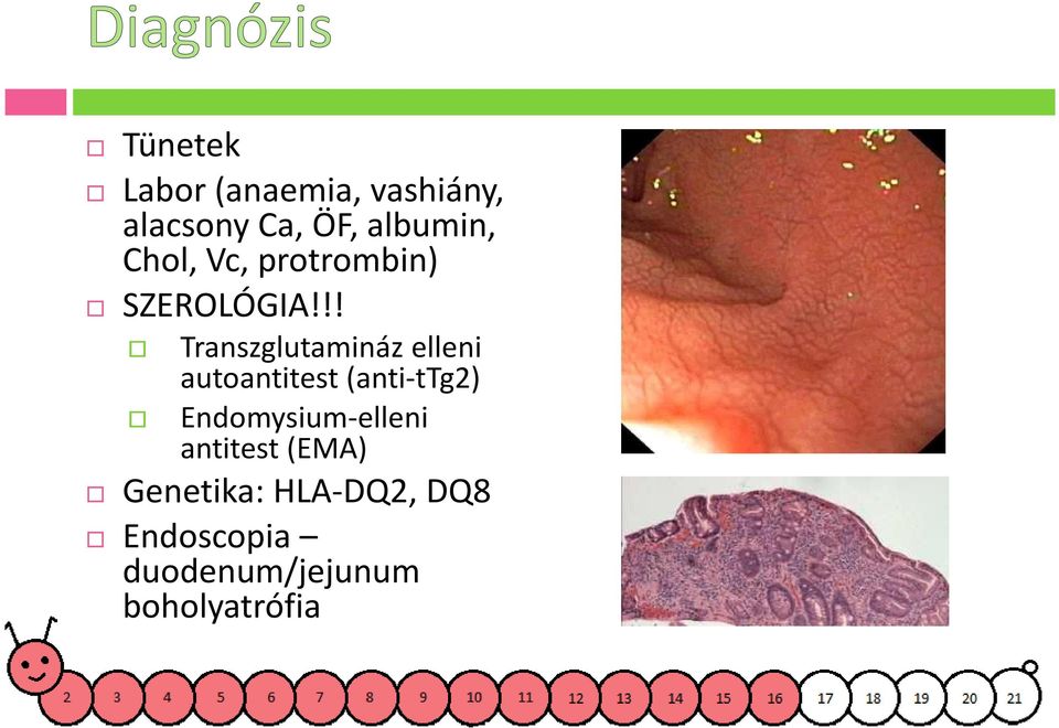 !! Transzglutaminázelleni autoantitest(anti-ttg2)