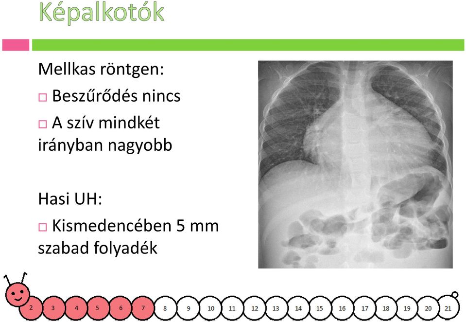 irányban nagyobb Hasi UH: