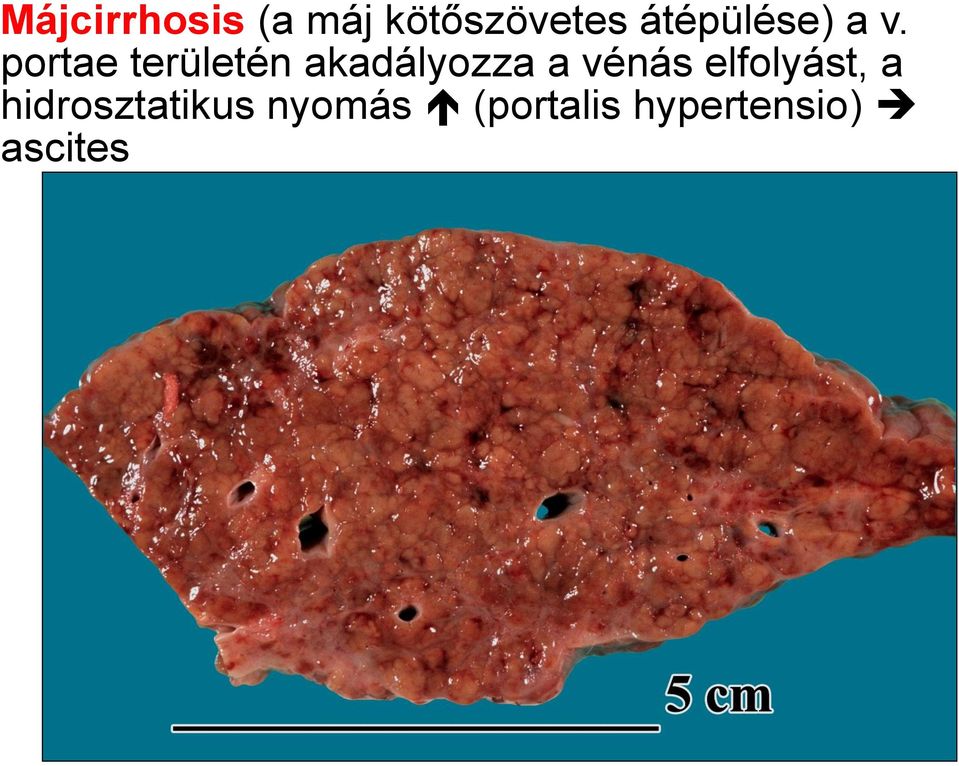 portae területén akadályozza a vénás