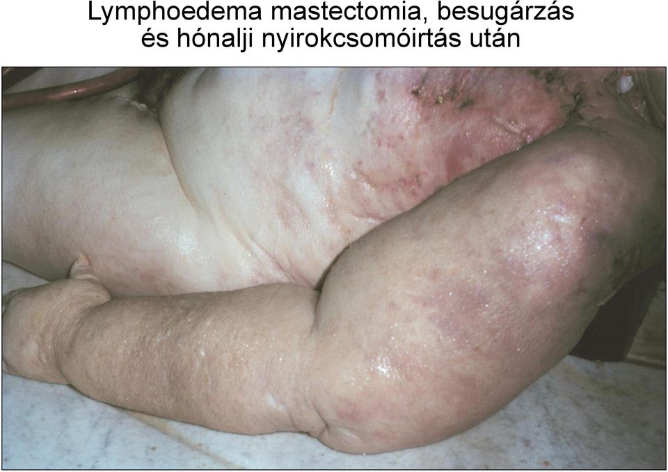besugárzás és