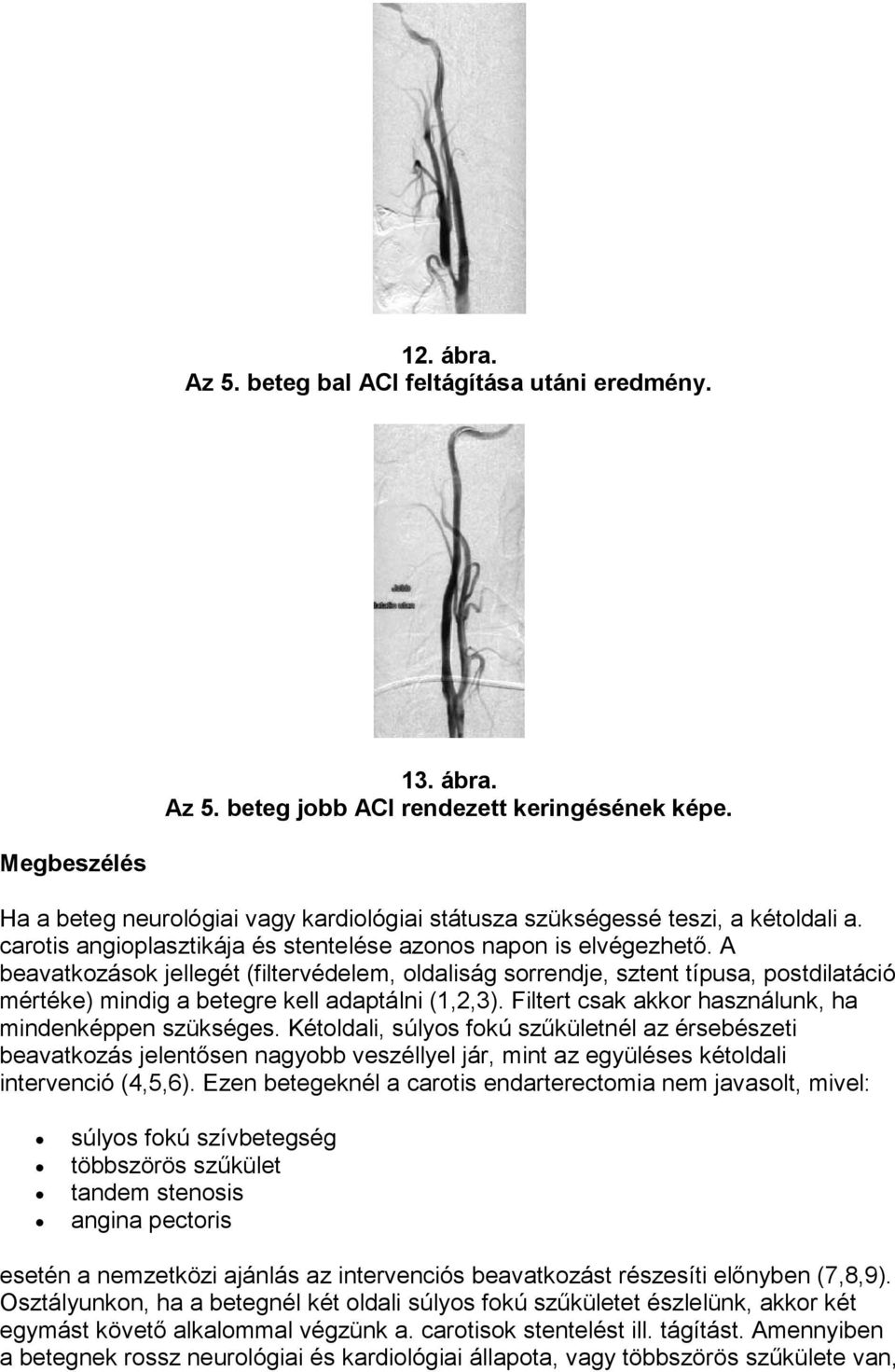 A beavatkozások jellegét (filtervédelem, oldaliság sorrendje, sztent típusa, postdilatáció mértéke) mindig a betegre kell adaptálni (1,2,3). Filtert csak akkor használunk, ha mindenképpen szükséges.