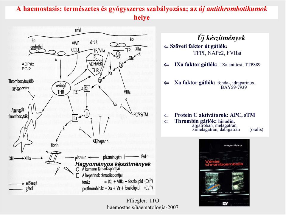 antitest, TTP889 Xa faktor gátlók: fonda-, idraparinux, BAY59-7939 Protein C aktivátorok: APC,