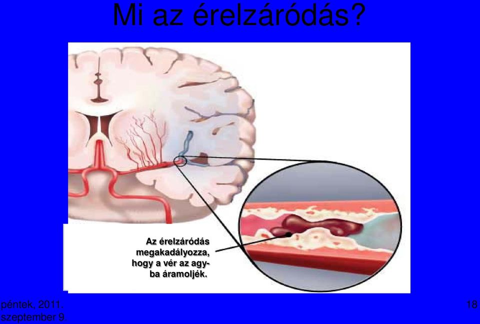 megakadályozza, hogy