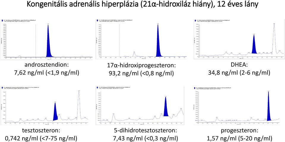 (<0,8 ng/ml) DHEA: 34,8 ng/ml (2-6 ng/ml) tesztoszteron: 0,742 ng/ml (<7-75