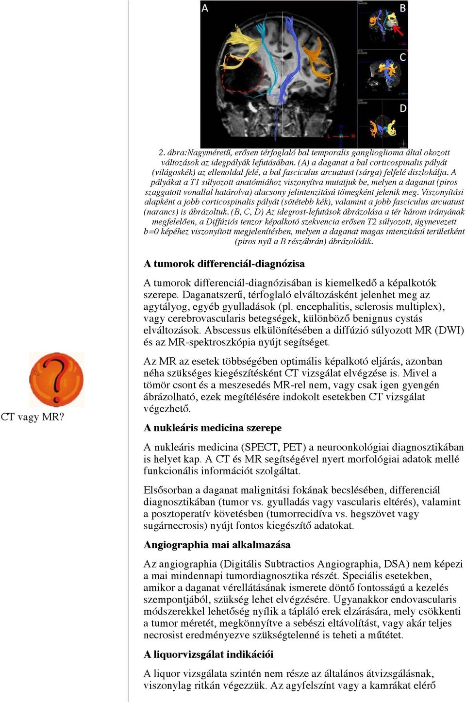 A pályákat a T1 súlyozott anatómiához viszonyítva mutatjuk be, melyen a daganat (piros szaggatott vonallal határolva) alacsony jelintenzitású tömegként jelenik meg.