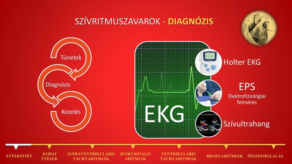 Kezelés EKG EPS