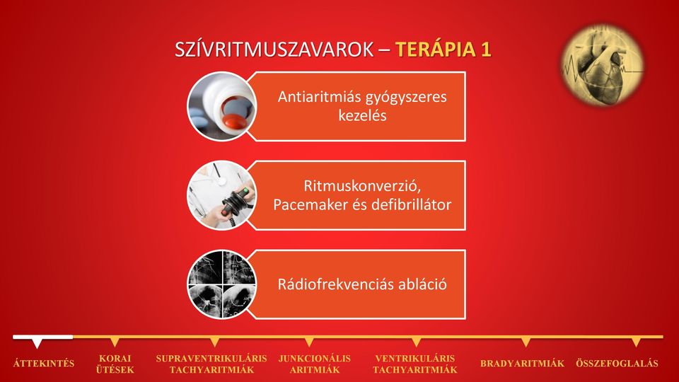 Ritmuskonverzió, Pacemaker és