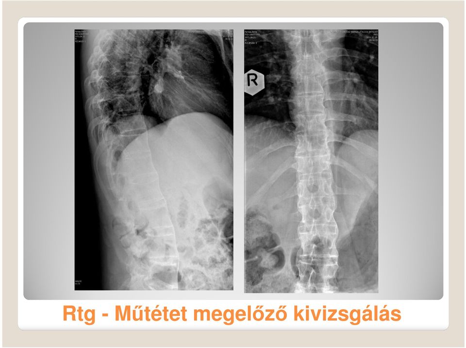 megelőző