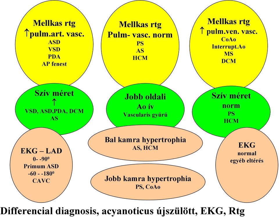 Ao MS DCM Szív méret VSD, ASD,PDA, DCM AS EKG LAD 0- -90 0 Primum ASD -60 - -180 0 CAVC Jobb oldali Ao ív