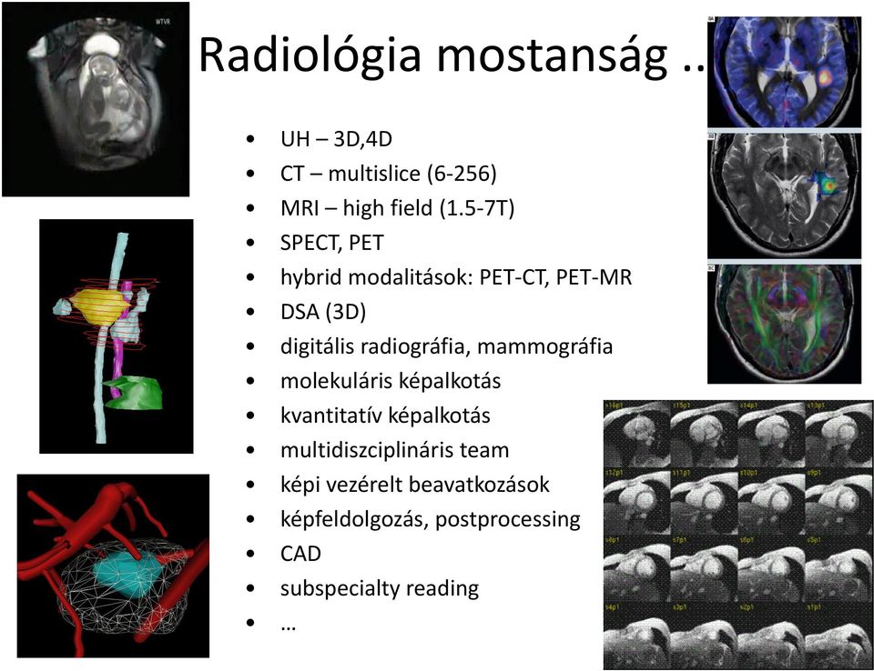 radiográfia, mammográfia molekuláris képalkotás kvantitatív képalkotás