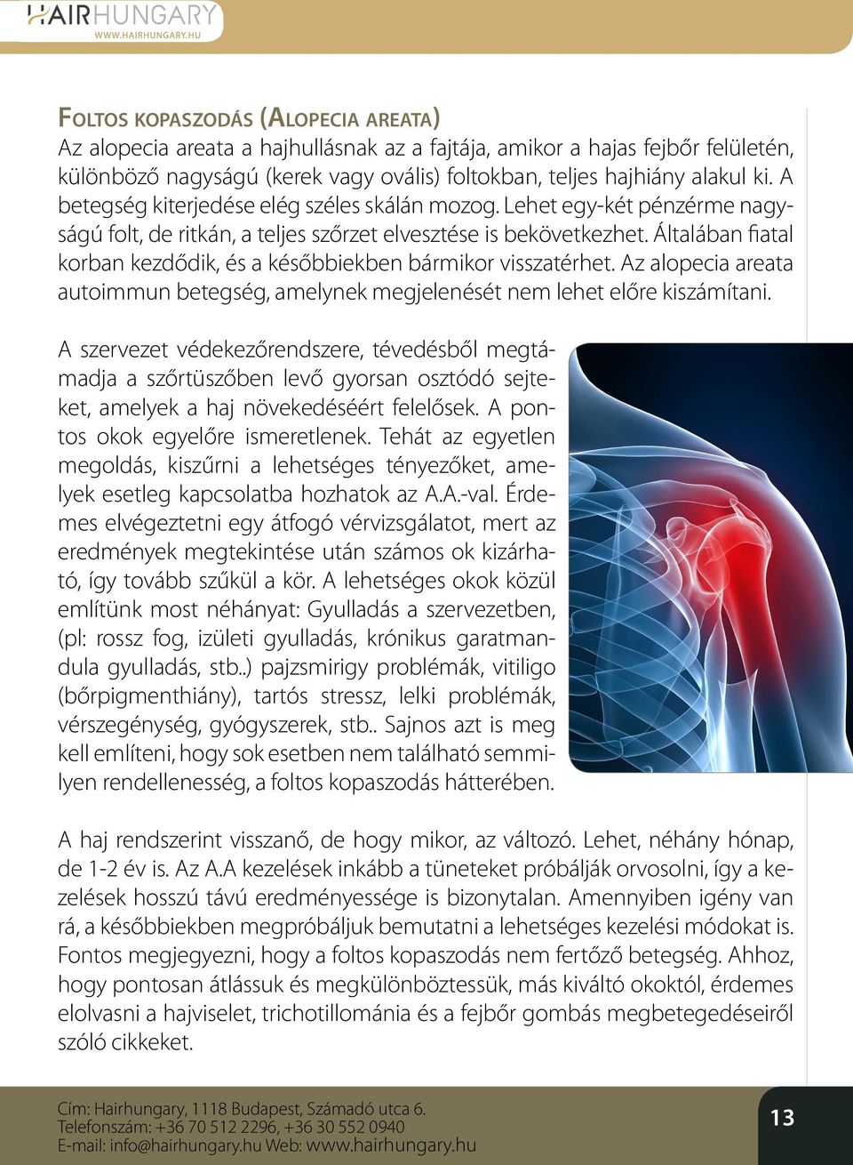 Általában fiatal korban kezdődik, és a későbbiekben bármikor visszatérhet. Az alopecia areata autoimmun betegség, amelynek megjelenését nem lehet előre kiszámítani.