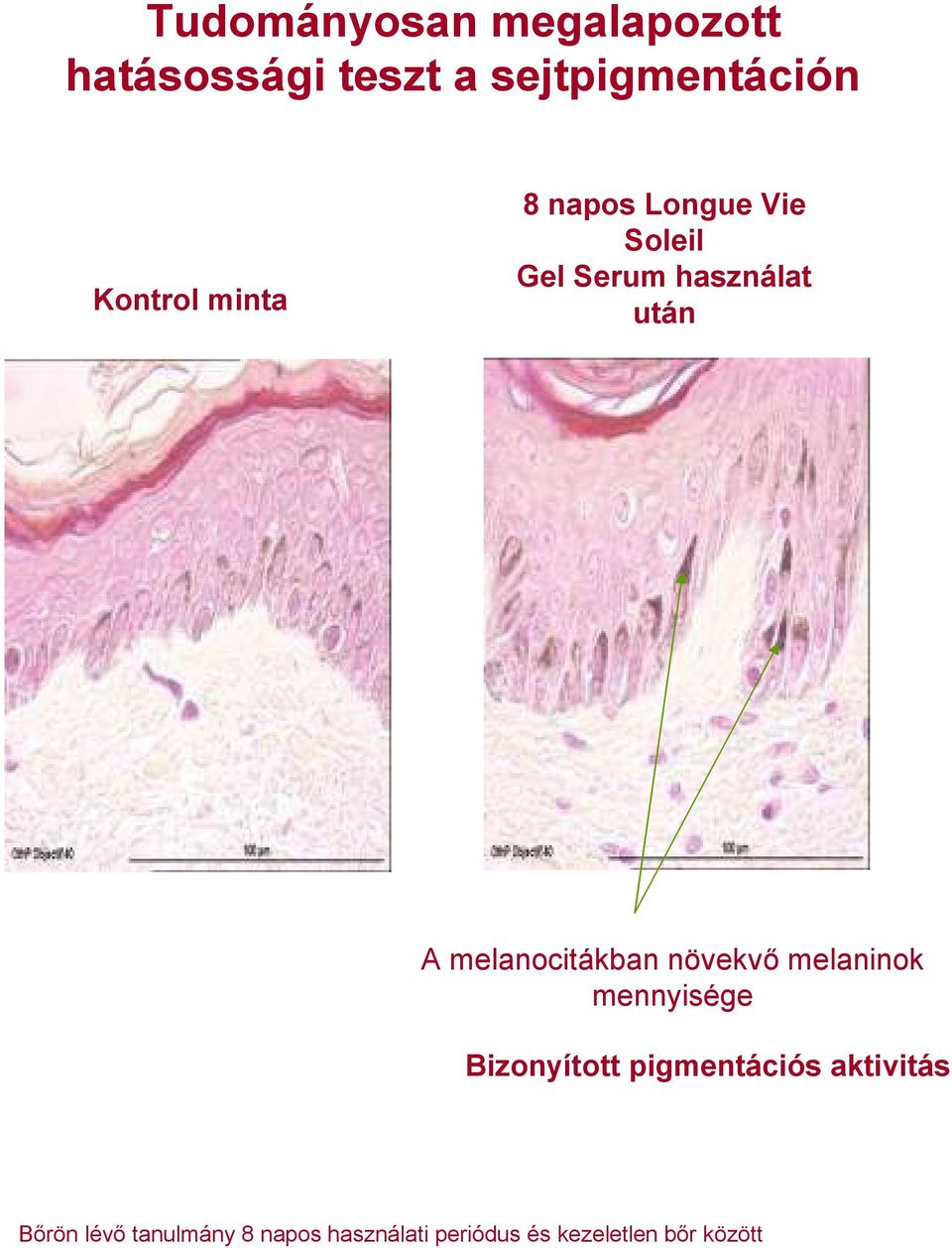 melanocitákban növekvő melaninok mennyisége Bizonyított pigmentációs