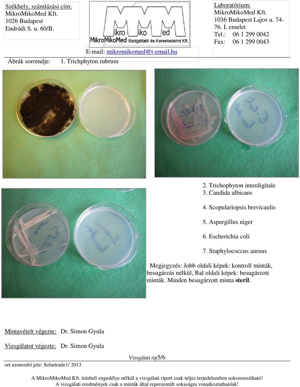 Staphylococcus aureus Megjegyzés: Jobb oldali képek: kontroll minták, besugárzás nélkül, Bal oldali képek: besugárzott minták.