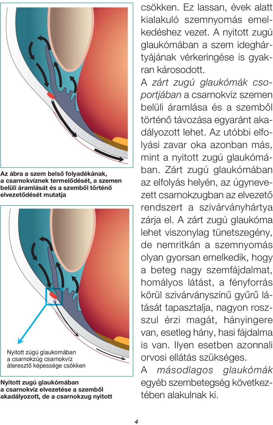 A nyitott zugú glaukómában a szem ideghártyájának vérkeringése is gyakran károsodott.