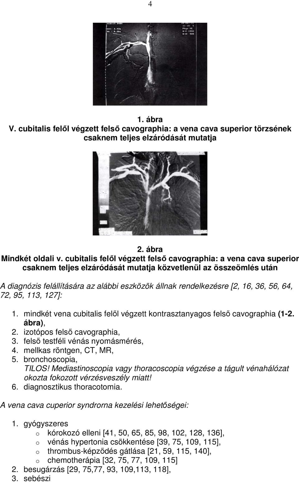 16, 36, 56, 64, 72, 95, 113, 127]: 1. mindkét vena cubitalis felıl végzett kontrasztanyagos felsı cavographia (1-2. ábra), 2. izotópos felsı cavographia, 3. felsı testféli vénás nyomásmérés, 4.