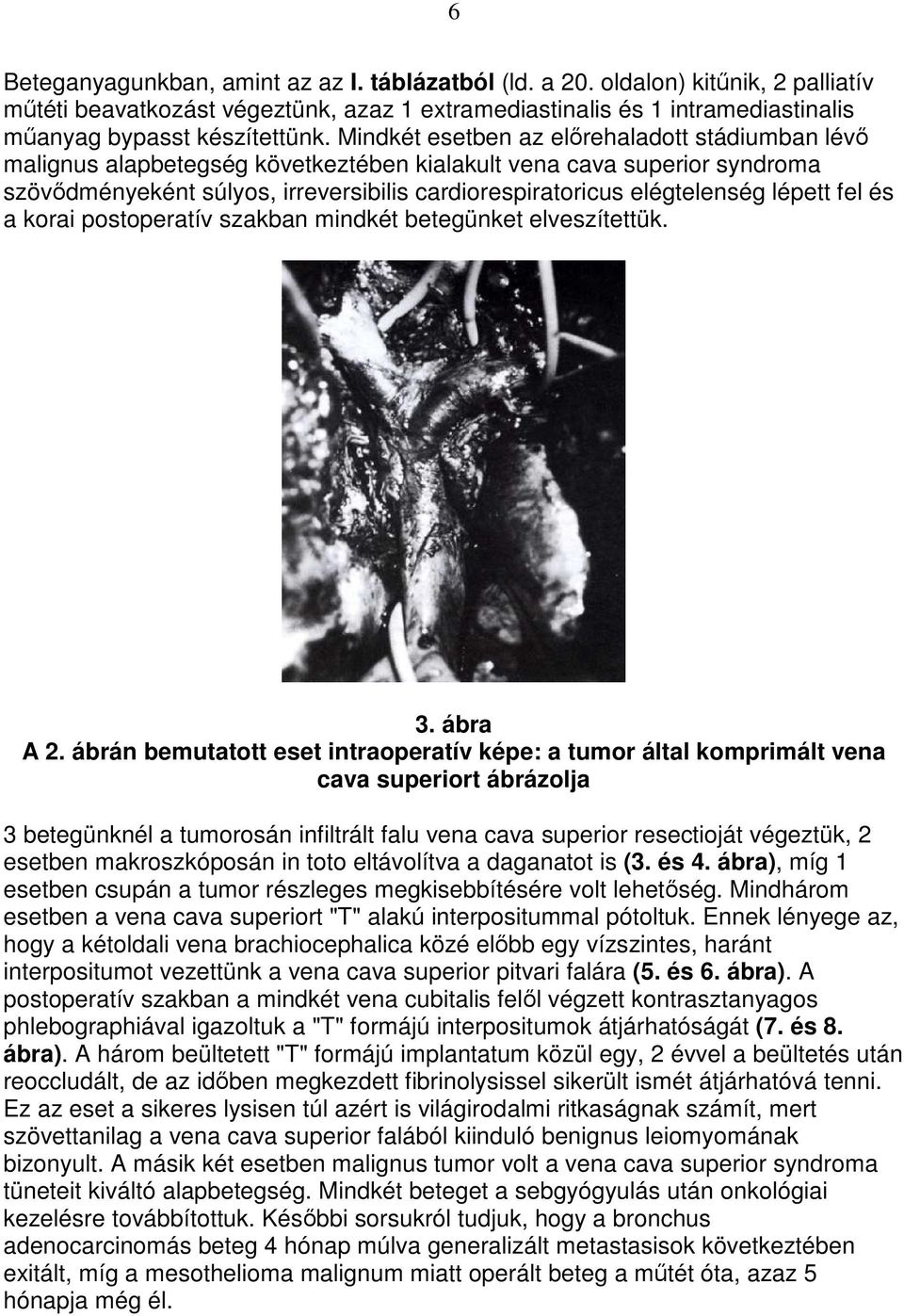 lépett fel és a korai postoperatív szakban mindkét betegünket elveszítettük. 3. ábra A 2.