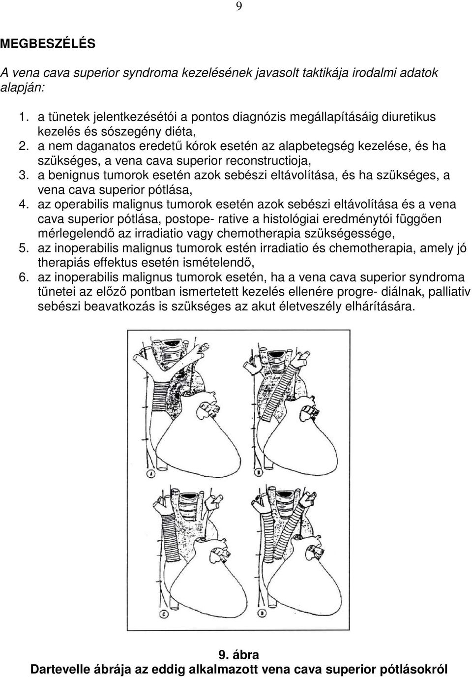 a nem daganatos eredető kórok esetén az alapbetegség kezelése, és ha szükséges, a vena cava superior reconstructioja, 3.