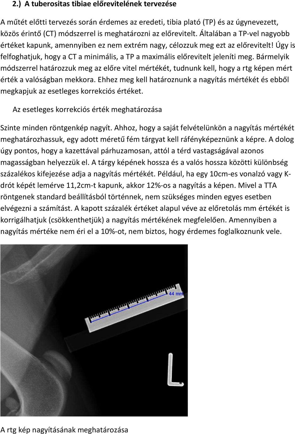 Bármelyik módszerrel határozzuk meg az előre vitel mértékét, tudnunk kell, hogy a rtg képen mért érték a valóságban mekkora.