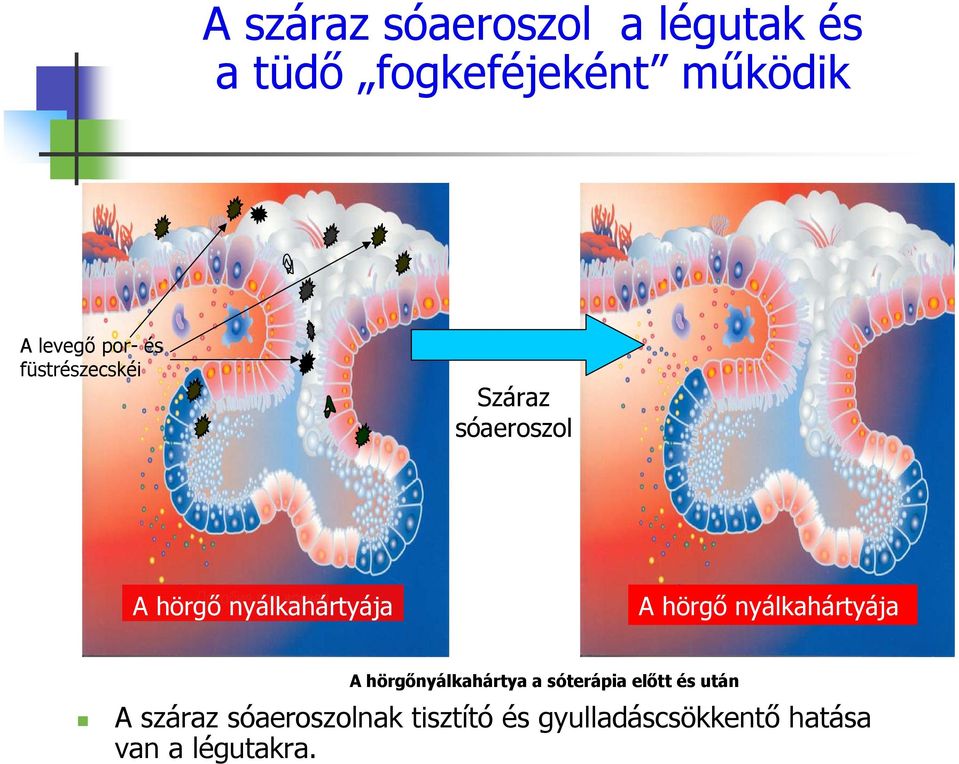 hörgő nyálkahártyája A hörgőnyálkahártya a sóterápia előtt és után A