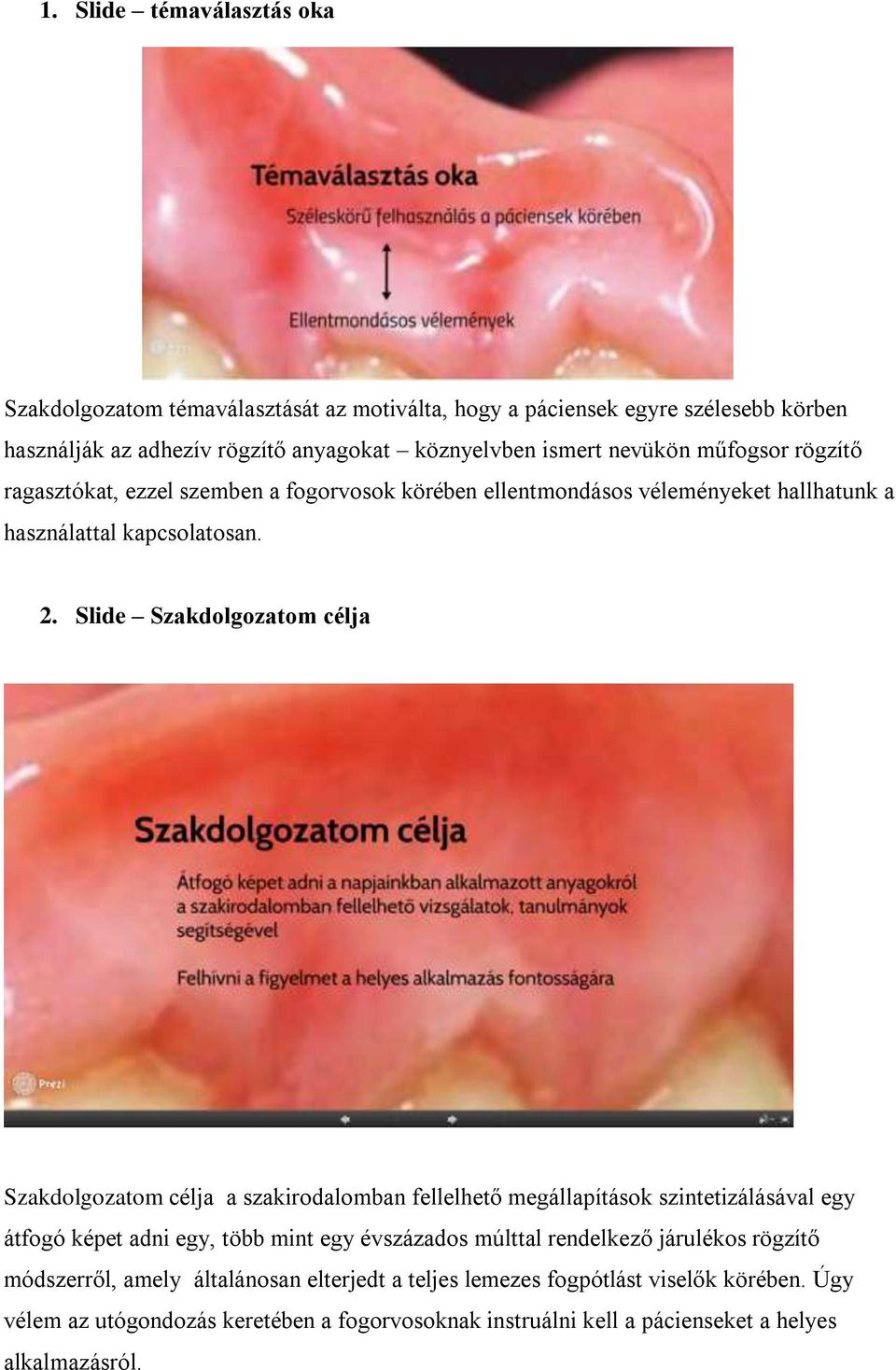 Slide Szakdolgozatom célja Szakdolgozatom célja a szakirodalomban fellelhető megállapítások szintetizálásával egy átfogó képet adni egy, több mint egy évszázados múlttal