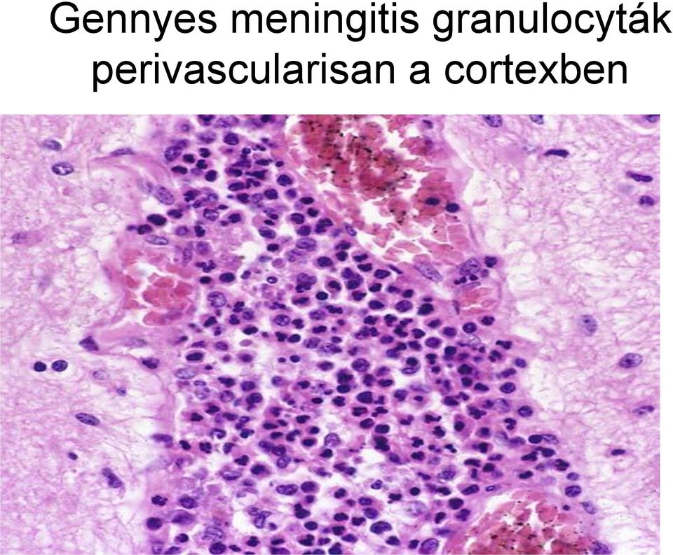 granulocyták