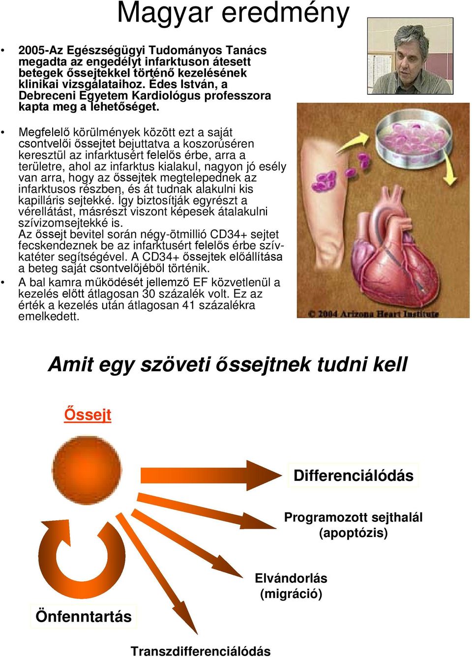 Megfelelő körülmények között ezt a saját csontvelői őssejtet bejuttatva a koszorúséren keresztül az infarktusért felelős érbe, arra a területre, ahol az infarktus kialakul, nagyon jó esély van arra,