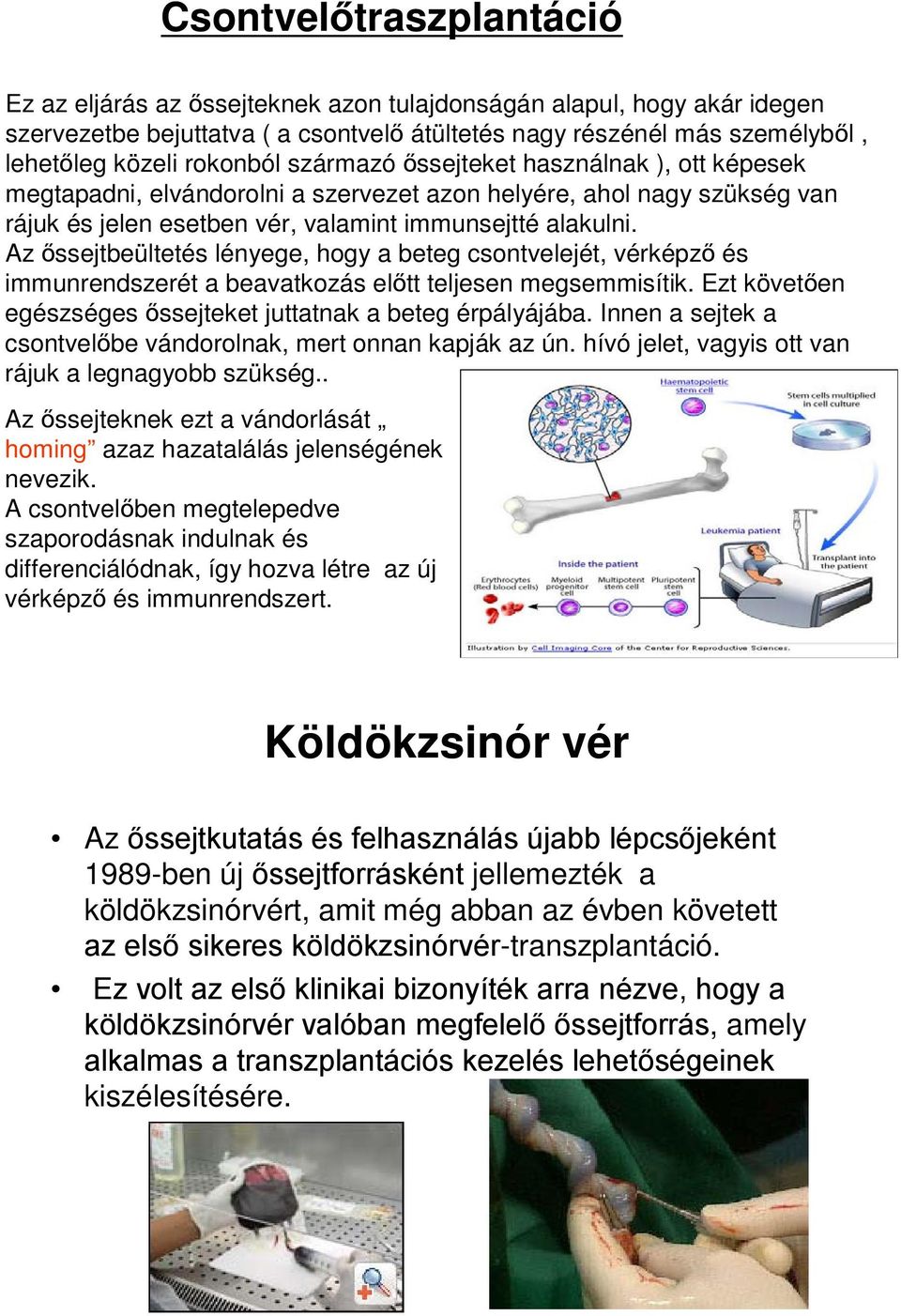 Az őssejtbeültetés lényege, hogy a beteg csontvelejét, vérképző és immunrendszerét a beavatkozás előtt teljesen megsemmisítik. Ezt követően egészséges őssejteket juttatnak a beteg érpályájába.