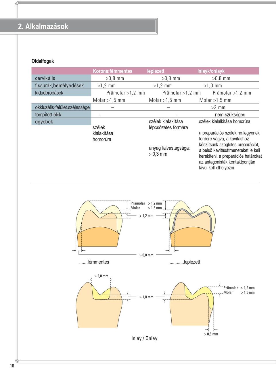 szélessége >2 mm tompított-élek - - nem-szükséges egyebek szélek kialakítása homorúra szélek kialakítása lépcsõzetes formára anyag falvastagsága: > 0,3 mm szélek kialalkítása homorúra a preparációs