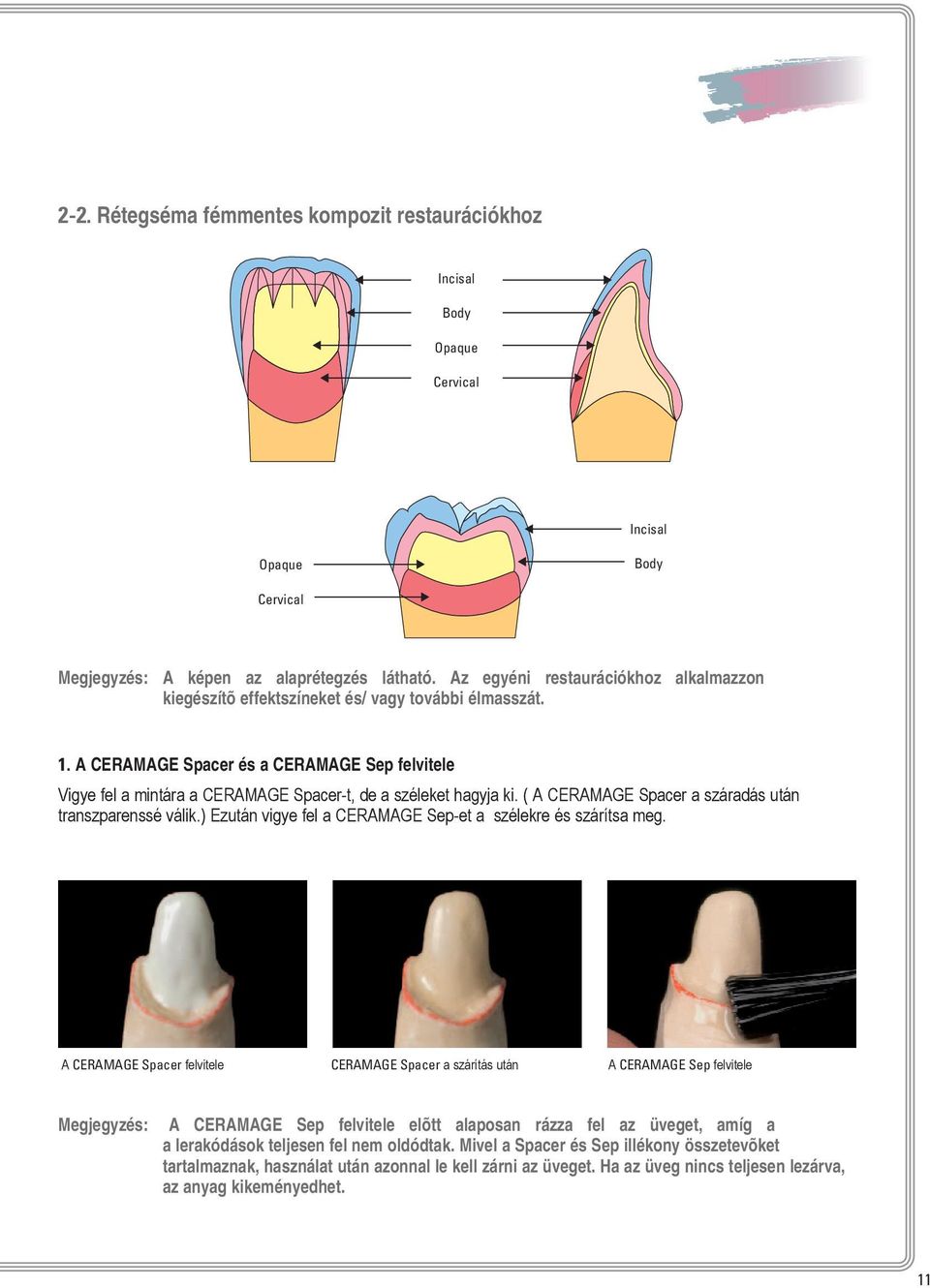 A CERAMAGE Spacer és a CERAMAGE Sep felvitele Vigye fel a mintára a CERAMAGE Spacer-t, de a széleket hagyja ki. ( A CERAMAGE Spacer a száradás után transzparenssé válik.