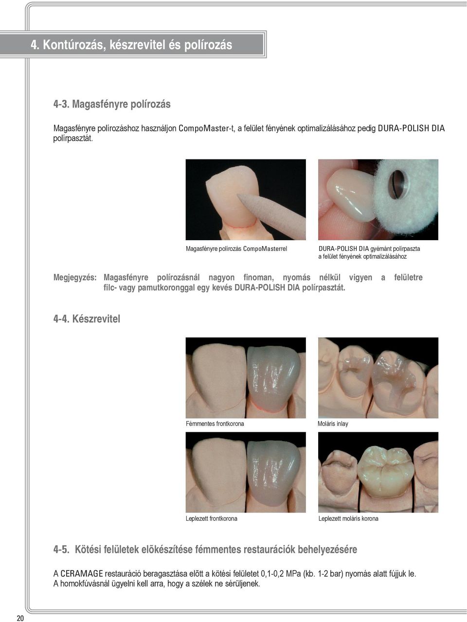 filc- vagy pamutkoronggal egy kevés DURA-POLISH DIA polírpasztát. 4-4. Készrevitel Fémmentes frontkorona Moláris inlay Leplezett frontkorona Leplezett moláris korona 4-5.