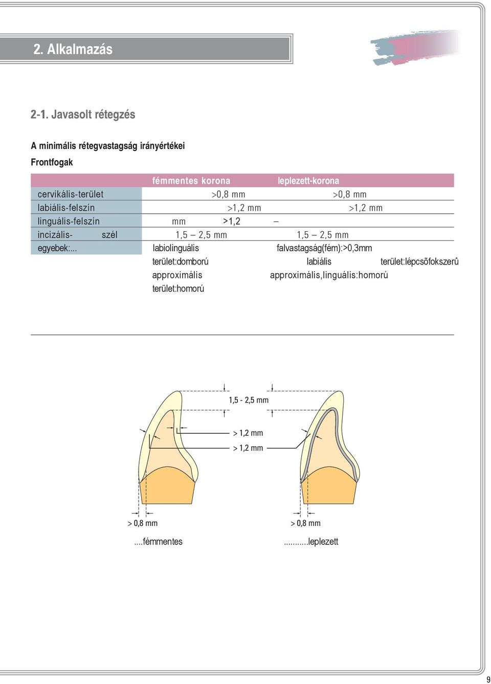 cervikális-terület >0,8 mm >0,8 mm labiális-felszín >1,2 mm >1,2 mm linguális-felszín mm >1,2 incizális- szél 1,5 2,5 mm