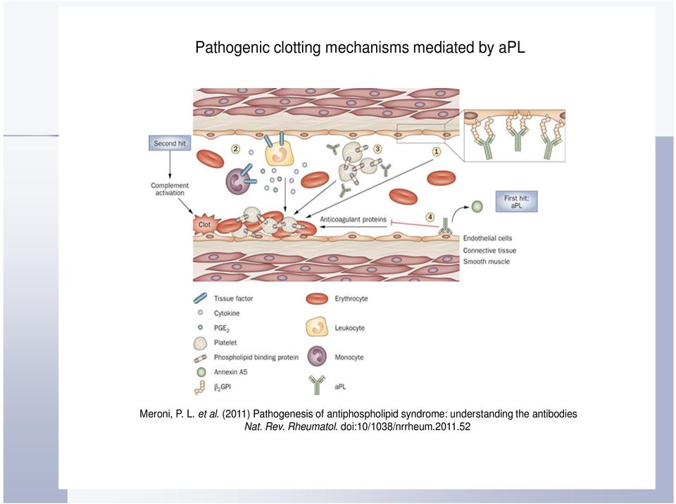 (2011) Pathogenesis of antiphospholipid