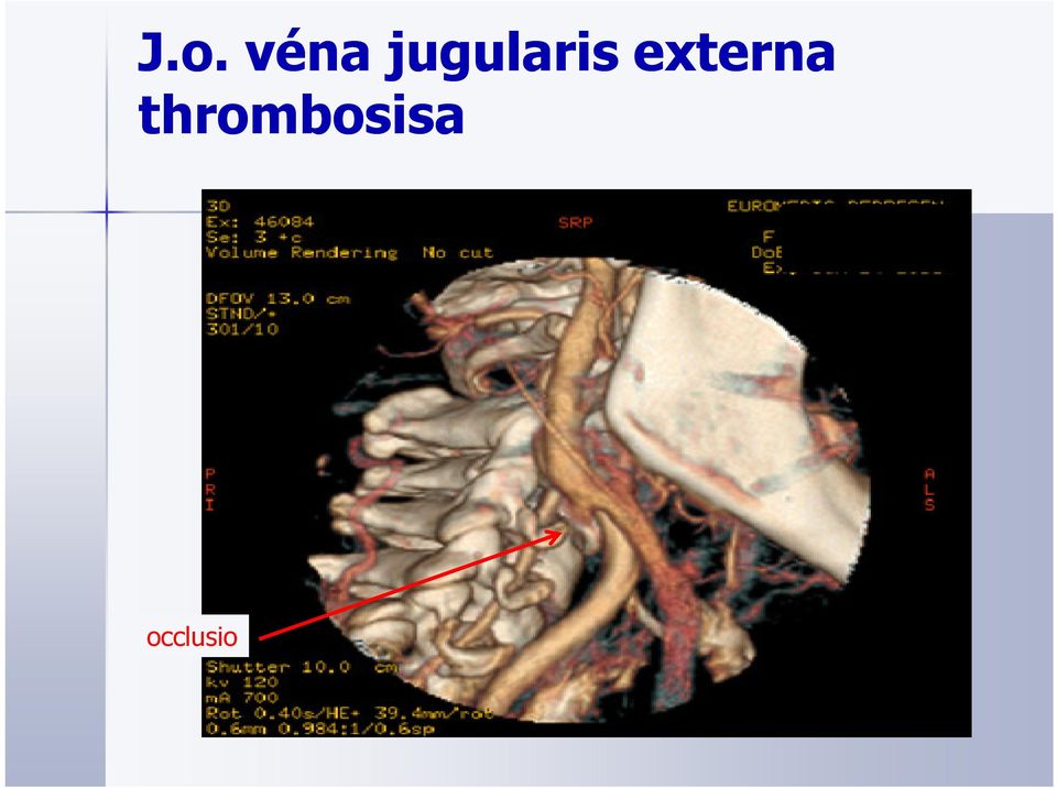 externa