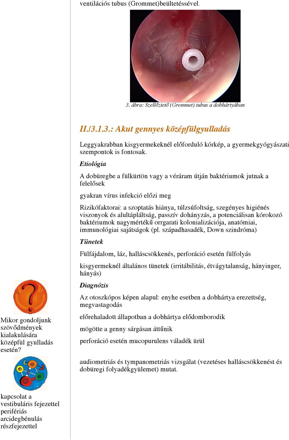 Etiológia A dobüregbe a fülkürtön vagy a véráram útján baktériumok jutnak a felelősek gyakran vírus infekció előzi meg Rizikófaktorai: a szoptatás hiánya, túlzsúfoltság, szegényes higiénés viszonyok
