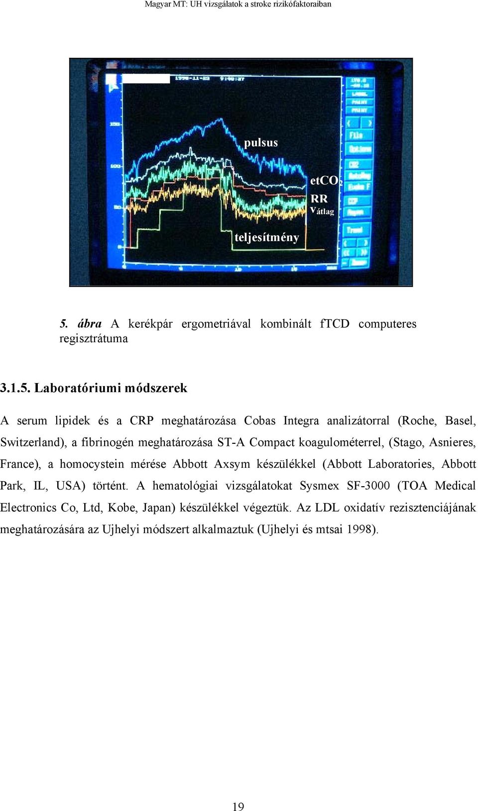 Laboratóriumi módszerek A serum lipidek és a CRP meghatározása Cobas Integra analizátorral (Roche, Basel, Switzerland), a fibrinogén meghatározása ST-A Compact
