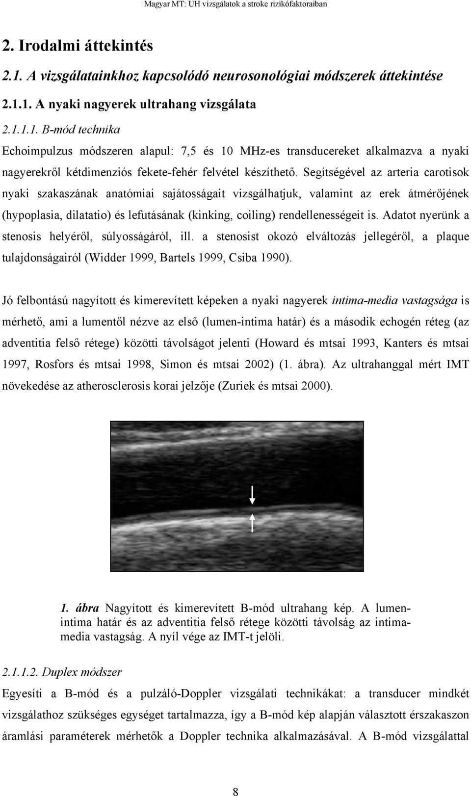 Adatot nyerünk a stenosis helyér l, súlyosságáról, ill. a stenosist okozó elváltozás jellegér l, a plaque tulajdonságairól (Widder 1999, Bartels 1999, Csiba 1990).