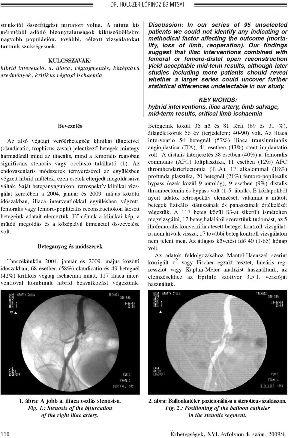 iliaca, végtagmentés, középtávú eredmények, kritikus végtagi ischaemia Discussion: In our series of 95 unselected patients we could not identify any indicating or methodical factor affecting the