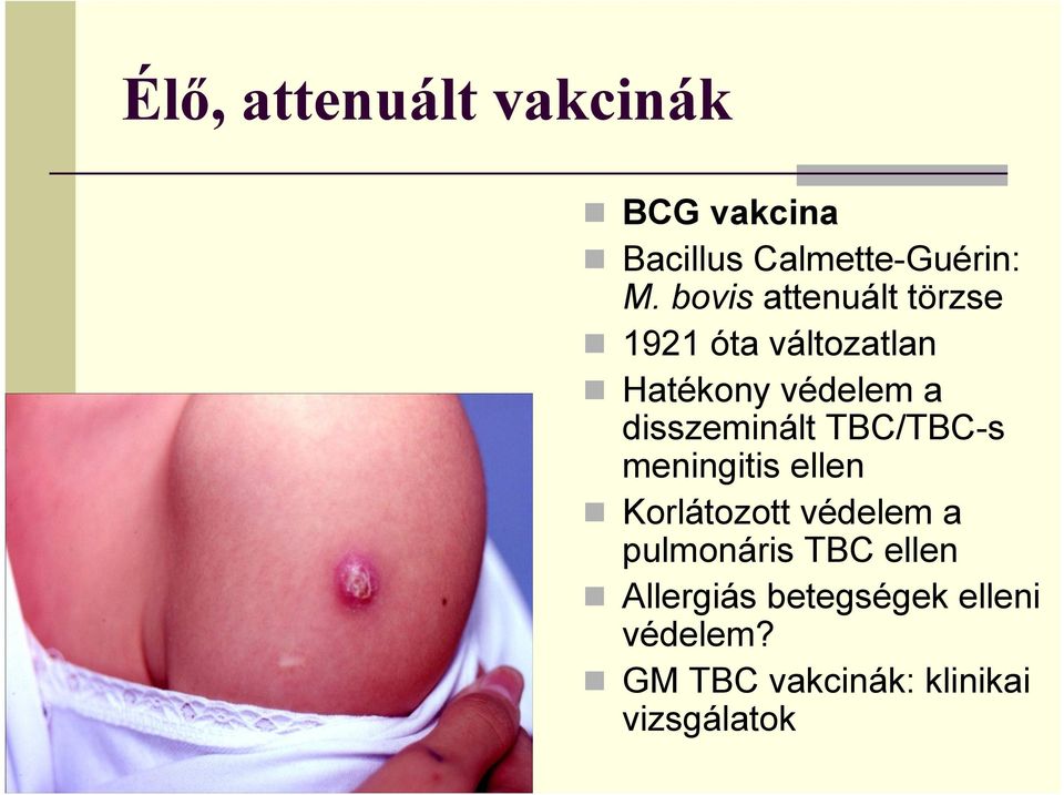 disszeminált TBC/TBC-s meningitis ellen Korlátozott védelem a