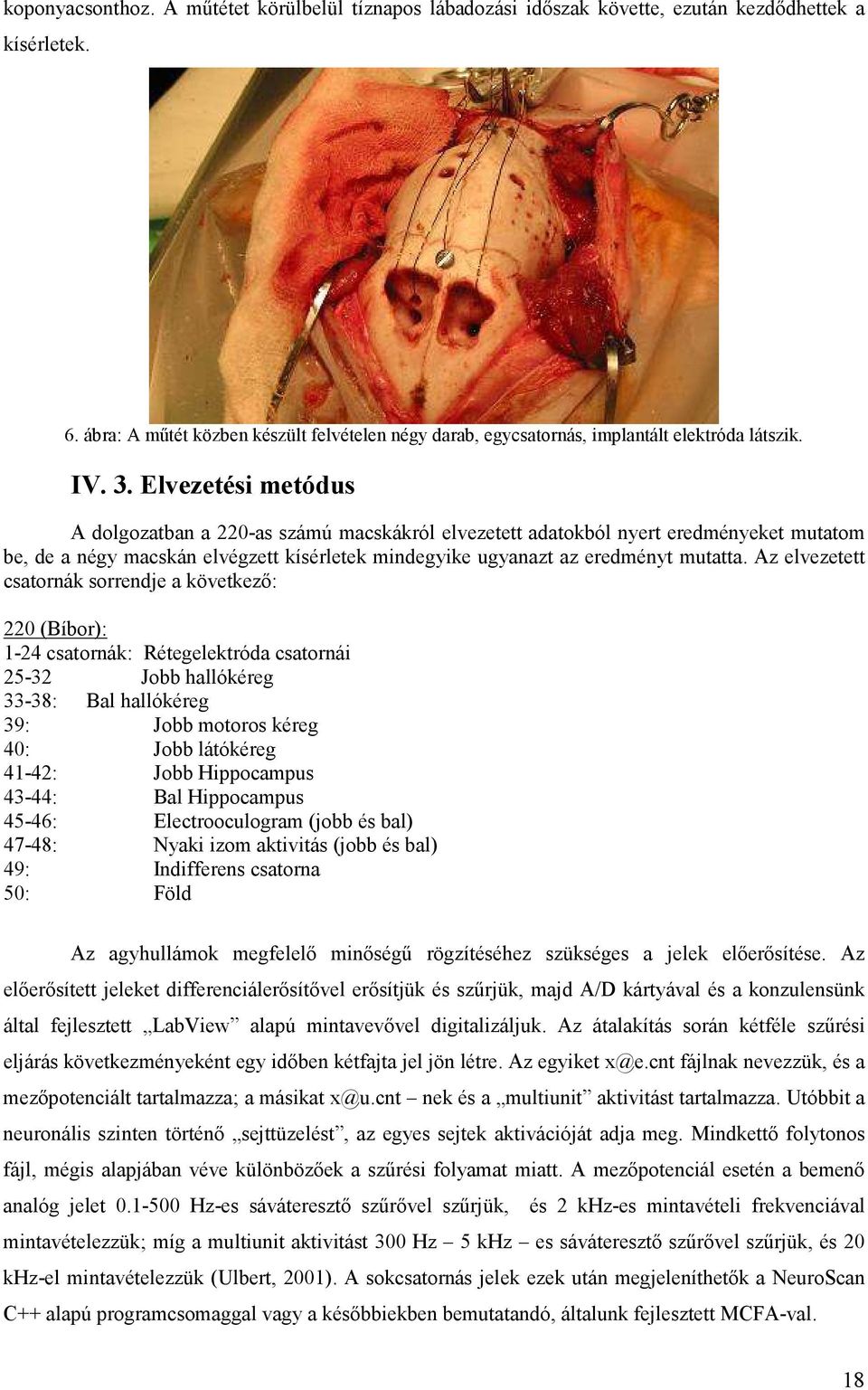 Elvezetési metódus A dolgozatban a 220-as számú macskákról elvezetett adatokból nyert eredményeket mutatom be, de a négy macskán elvégzett kísérletek mindegyike ugyanazt az eredményt mutatta.