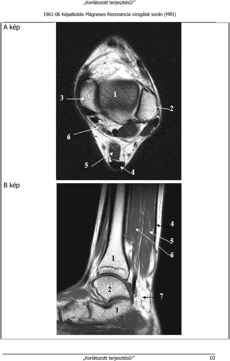 vizsgálat során (MRI)