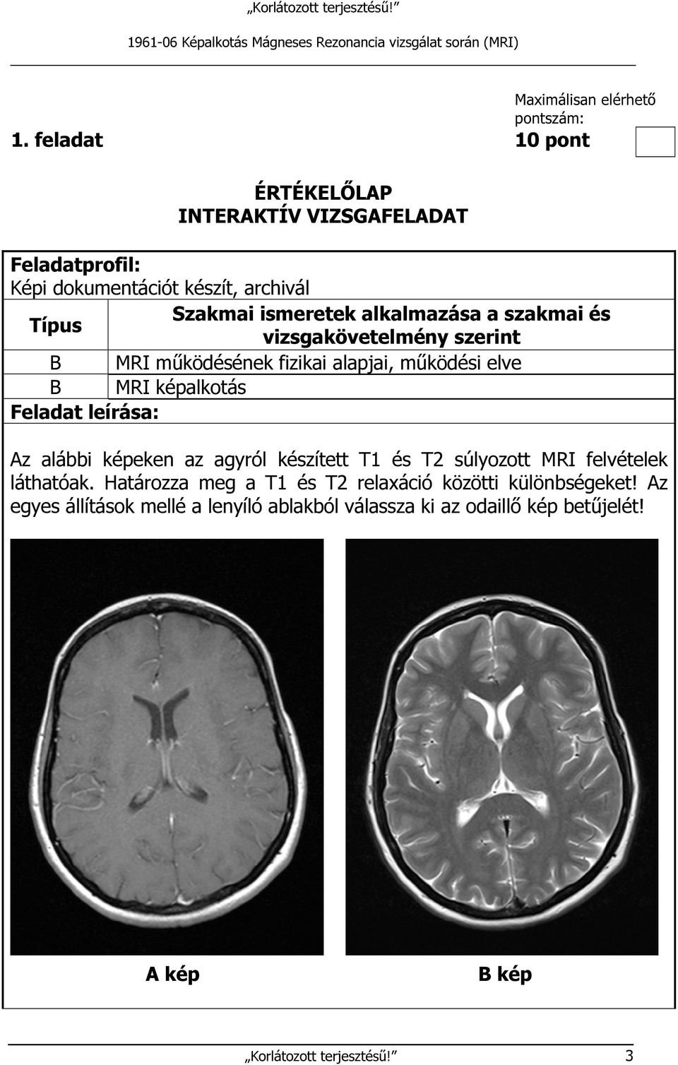 Típus vizsgakövetelmény szerint B MRI működésének fizikai alapjai, működési elve B MRI képalkotás Feladat leírása: Az alábbi képeken az agyról