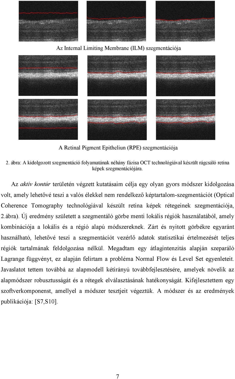 Az aktív kontúr területén végzett kutatásaim célja egy olyan gyors módszer kidolgozása volt, amely lehetıvé teszi a valós élekkel nem rendelkezı képtartalom-szegmentációt (Optical Coherence