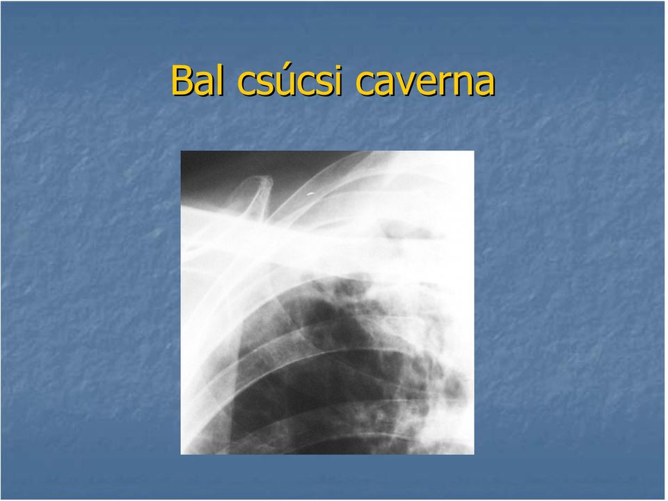 caverna