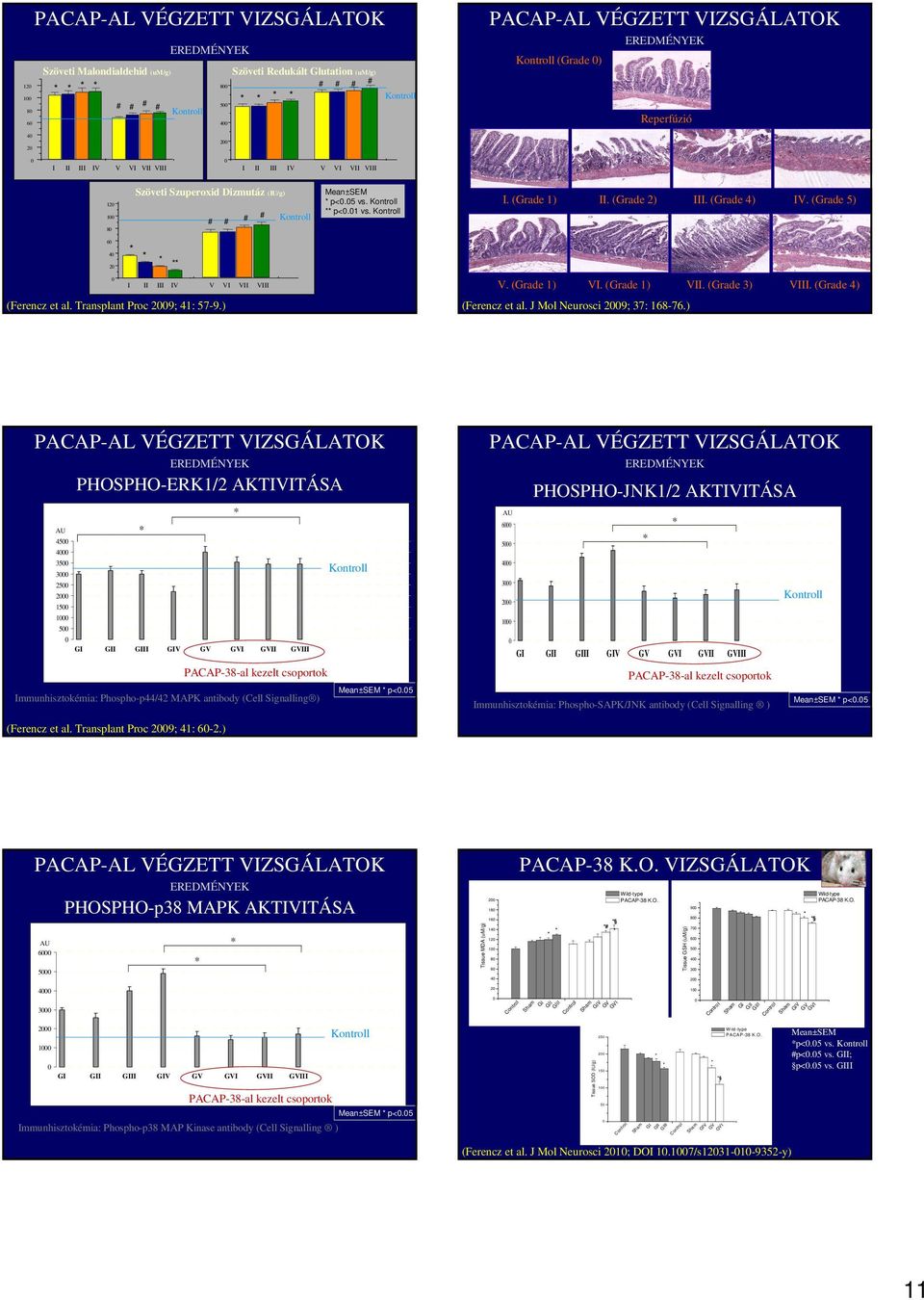 (Grade 1) VI. (Grade 1) VII. (Grade 3) VIII. (Grade 4) (Ferencz et al. J Mol Neurosci 29; 37: 16876.