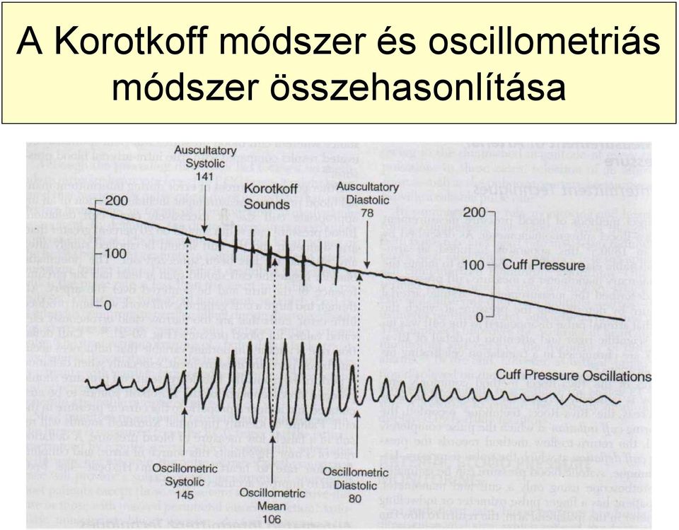 oscillometriás