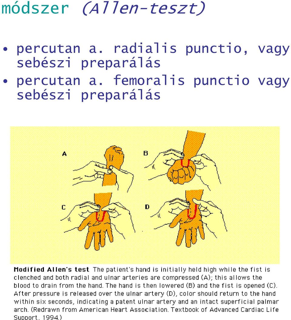 preparálás percutan a.