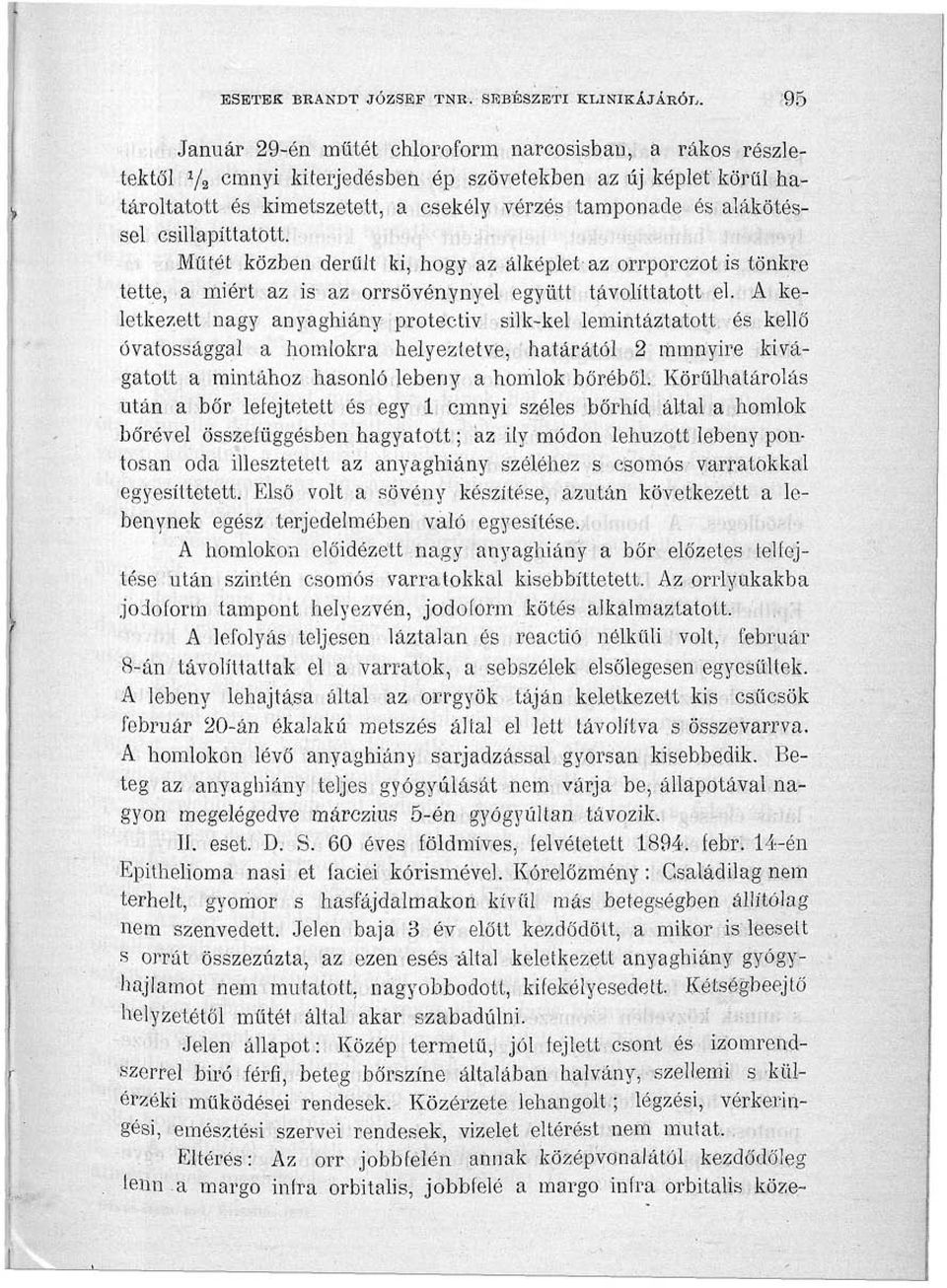 csillapíttatott. Műtét közben derűit ki, hogy az álképletaz orrporczot is tönkre tette, a miért az is az orrsövénynyel együtt távolíttatott el.