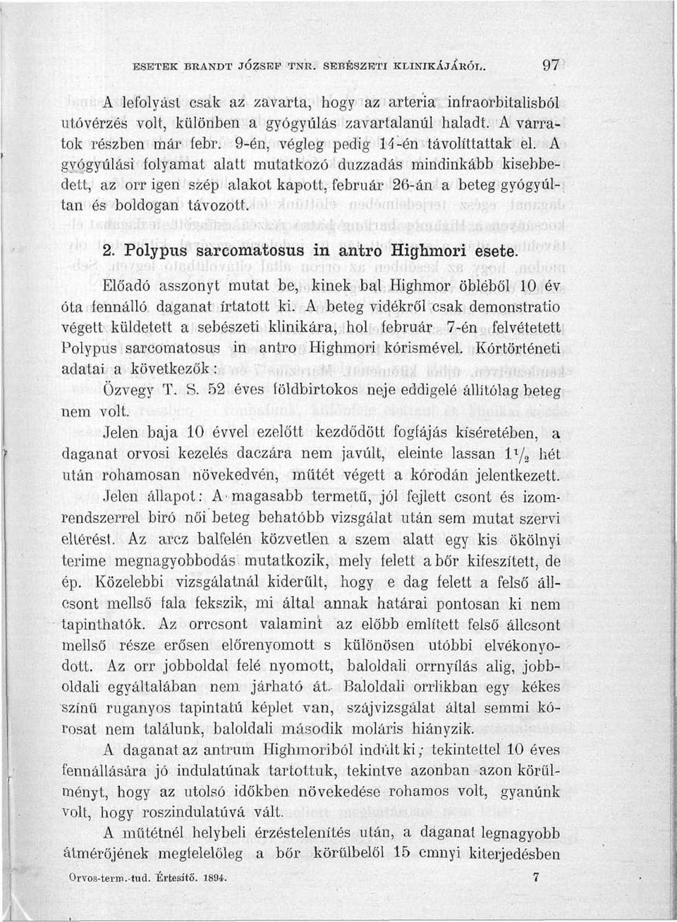 A gyógyulási folyamat alatt mutatkozó duzzadás mindinkább kisebbedett, az orr igen szép alakot kapott, február 26-án a beteg gyógyultan és boldogan távozott. 2. Polypus sarcomatosus in antro Highmori esete.